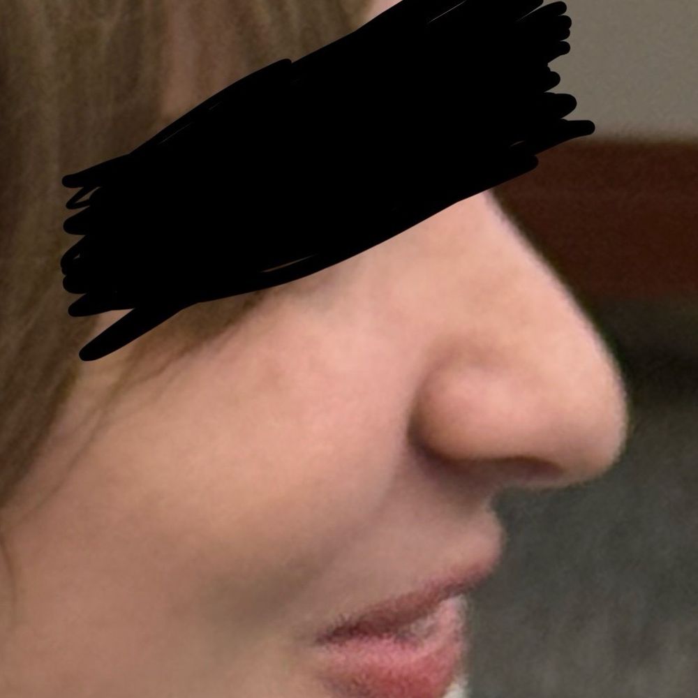 Sherber+rad - After - Cosmetic Surgeons Near Me - Washington, DC, District of Columbia