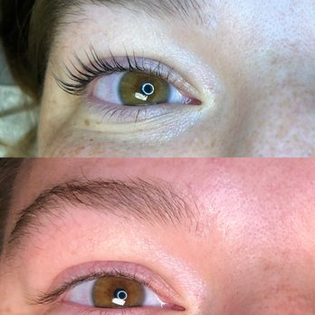 Fresh Beauty - Before (bottom) After (top) - Hair Removal Near Me - Mustang, Oklahoma Fresh Beauty - Before (bottom) After (top) - Hair Removal Near Me - Mustang, Oklahoma