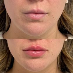 Clinique Derma MD