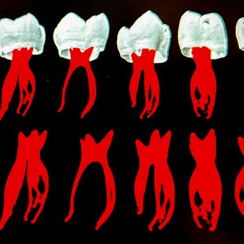 Richard Rauth, DDS, MS - Experience a unique version of patient care. I give 100% of my attention to every patient I see-the standard for Santa Monica Endodontics - Endodontists Near Me - Santa Monica, California Richard Rauth, DDS, MS - Experience a unique version of patient care. I give 100% of my attention to every patient I see-the standard for Santa Monica Endodontics - Endodontists Near Me - Santa Monica, California