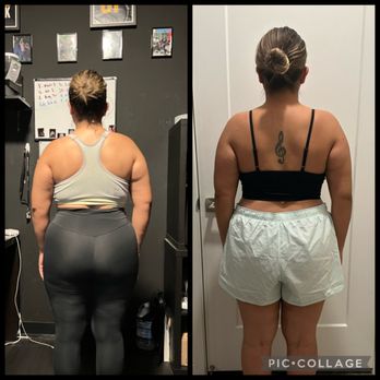 REPZ - 6 month results - Massage Therapy Near Me - Orange, California REPZ - 6 month results - Massage Therapy Near Me - Orange, California