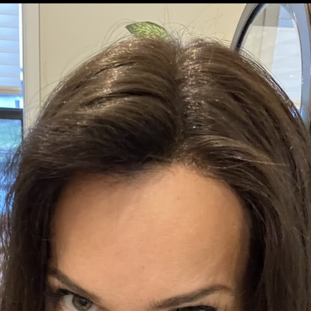 This is the hairline the day I sent the wig in This is the hairline the day I sent the wig in