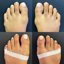 Abraham Wagner, DPM - Bunion Removal Surgery