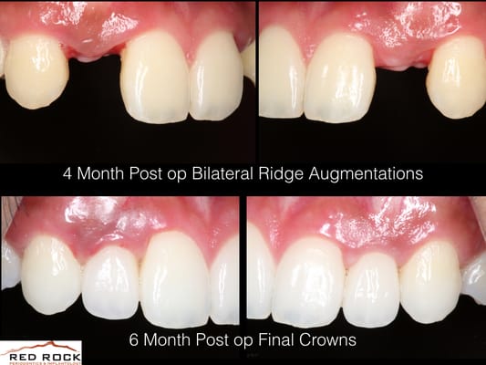RED ROCK PERIODONTICS & IMPLANTOLOGY - Updated July 2026 - 43 Photos ...