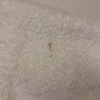Hilton Motif Seattle - Brown,green stain on towel that was folded up Under the sink ready for use. - Hotels Near Me - Seattle, Washington Hilton Motif Seattle - Brown,green stain on towel that was folded up Under the sink ready for use. - Hotels Near Me - Seattle, Washington