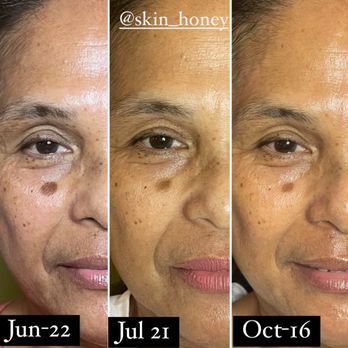 Skin Honey - Skin Care Near Me - Los Angeles, California Skin Honey - Skin Care Near Me - Los Angeles, California
