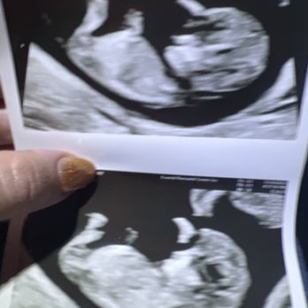 Coastal Perinatal Center - Obstetricians & Gynecologists Near Me - Torrance, California Coastal Perinatal Center - Obstetricians & Gynecologists Near Me - Torrance, California