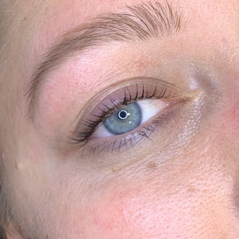 Fresh Beauty By Jen - After - Skin Care Near Me - Holladay, Utah Fresh Beauty By Jen - After - Skin Care Near Me - Holladay, Utah