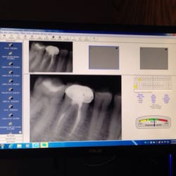 Carlisle William J III, DDS - Nice fancy and fast digital x-ray pics.  No more developer and waiting