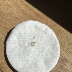 Associated Dermatologists - Stitches that were neglected to be removed.