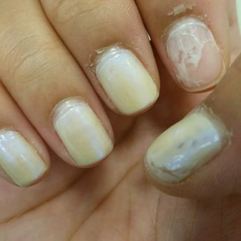 California Nails - 2 days after manicure. Index polish fell off immediately after, but could not return to get it fixed as I was leaving for a wedding event. - Nail Salons Near Me - Fairhaven, Massachusetts California Nails - 2 days after manicure. Index polish fell off immediately after, but could not return to get it fixed as I was leaving for a wedding event. - Nail Salons Near Me - Fairhaven, Massachusetts