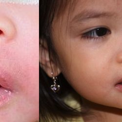 Lee Facial Plastic Surgery - Before and After from  Lee Facial Plastic Surgery  | Boston, MA