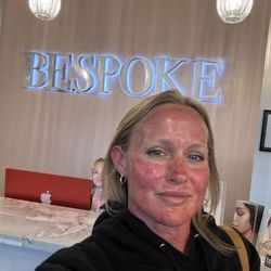 Bespoke Beauty - Great Microneedling treatment! It will go away in a few days and I'll look brand new!