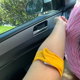 No bruises whatsoever