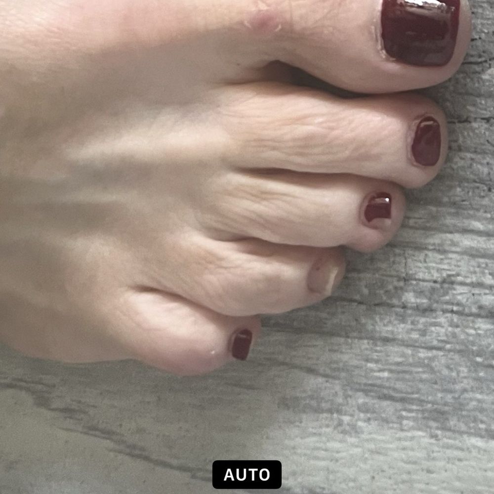 SUBSTANDARD PEDICURE