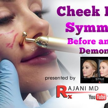 Style Aesthetics - https://www.youtube.com/watch?v=w1izopi8qIs
Dr Rajani injects dermal filler for cheek symmetry. Cheek Augmentation - Portland, Oregon - Medical Spas Near Me - Portland, Oregon Style Aesthetics - https://www.youtube.com/watch?v=w1izopi8qIs
Dr Rajani injects dermal filler for cheek symmetry. Cheek Augmentation - Portland, Oregon - Medical Spas Near Me - Portland, Oregon