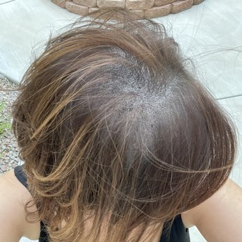 SMP INK - Excited for the progress - Hair Loss Centers Near Me - Las Vegas, Nevada