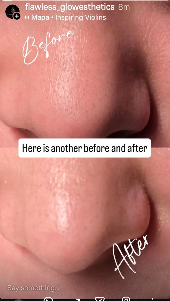 Flawless Glow Esthetics Logo
