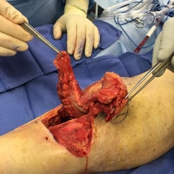 Lower Limb Institute: Mina Abadeer, DPM