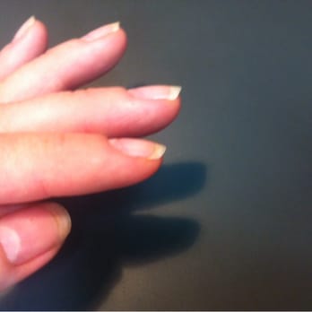 Paris Nails Spa - Ridges on my nails from using a drill to sand my cuticle beds during a manicure instead of using clippers to trim my cuticles. - Skin Care Near Me - Clarksville, Tennessee Paris Nails Spa - Ridges on my nails from using a drill to sand my cuticle beds during a manicure instead of using clippers to trim my cuticles. - Skin Care Near Me - Clarksville, Tennessee