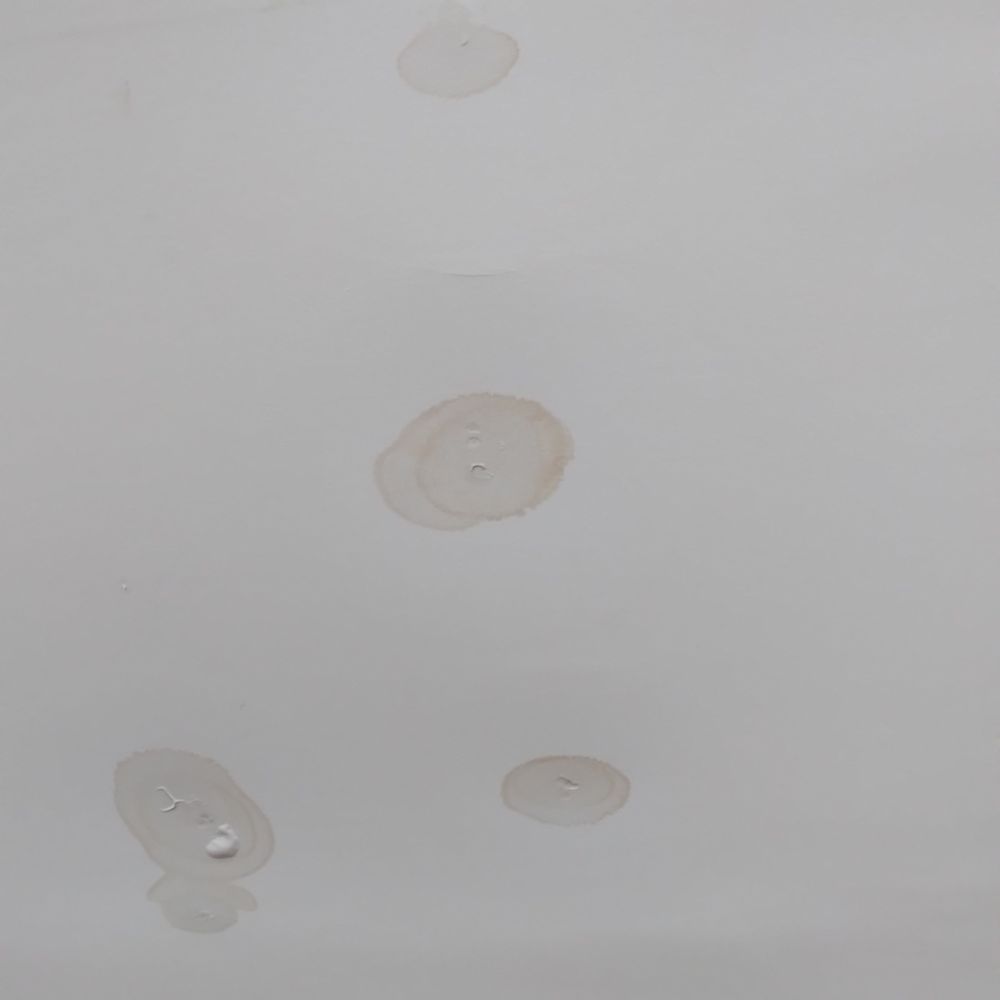 Capital Roofing Construction - Water damage in the ceiling of an apartment caused by the leaks in Capital's roof - Roofing Near Me Capital Roofing Construction - Water damage in the ceiling of an apartment caused by the leaks in Capital's roof - Roofing Near Me