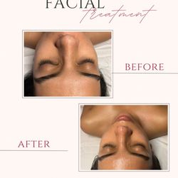 Deeper Than Skin - After deeper than glow facial. a beautiful reset!