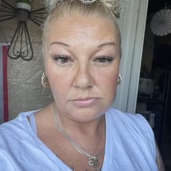 Bayfront Dental - This is how I woke up two days after the dentist told me I had nothing wrong with my tooth