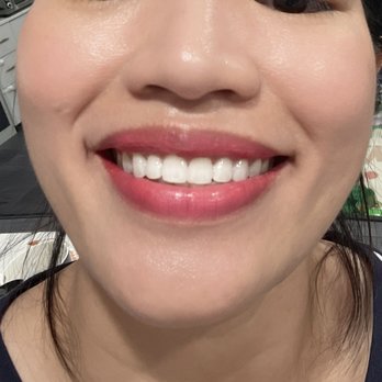 Thien Duy Bui, DDS, MSD - Orthodontists Near Me - San Jose, California Thien Duy Bui, DDS, MSD - Orthodontists Near Me - San Jose, California