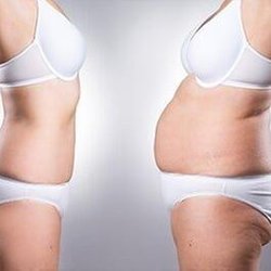 Advanced Medical Weight Loss at the Crothers Institute - Untitled