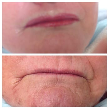 L'Atelier Permanent Makeup - Some pigmentation make your lips look fuller - Permanent Makeup Near Me - Osterville, Massachusetts L'Atelier Permanent Makeup - Some pigmentation make your lips look fuller - Permanent Makeup Near Me - Osterville, Massachusetts