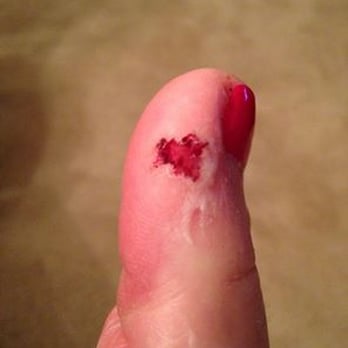 Serenity Nails & Spa - My mother's toe! - Skin Care Near Me - Saint Paul, Minnesota