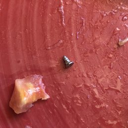 A closer picture of the screw that was left in a Papa Murphy's pizza that I've been to that is hurting my tooth A closer picture of the screw that was left in a Papa Murphy's pizza that I've been to that is hurting my tooth