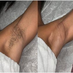 Diya Beauty Studio - Underarms waxing..