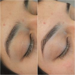 iBrow Beauty Clinic