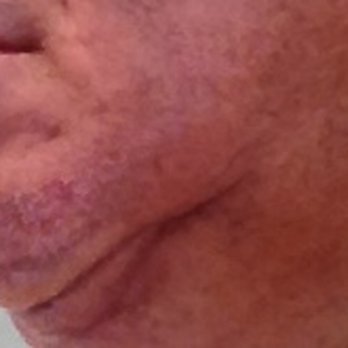 Jerry Darm, MD - Aestheticians Near Me - Lake Oswego, Oregon