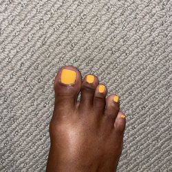 Nail Time - My sore big toe from a painful pedicure