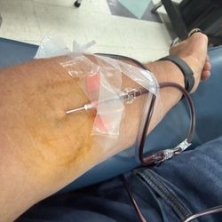 CSL Plasma - Arm