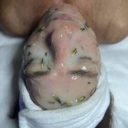 Holistic Esti