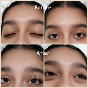 Valencia Body Contouring - Lash Lift - Body Contouring Near Me - Calgary, Alberta Valencia Body Contouring - Lash Lift - Body Contouring Near Me - Calgary, Alberta