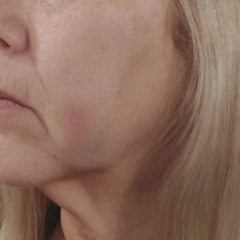 West Wind Dental - Face bruised - Cosmetic Dentists Near Me - Portage, Michigan West Wind Dental - Face bruised - Cosmetic Dentists Near Me - Portage, Michigan