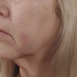 West Wind Dental - Face bruised