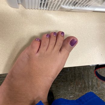 Paradise Tomball Nails & Spa - Swollen, infected and painful pinky toe! - Nail Salons Near Me - Tomball, Texas