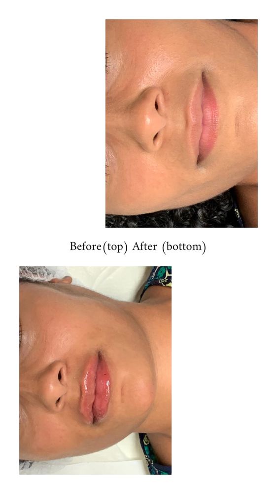 Needleless Beaute Logo