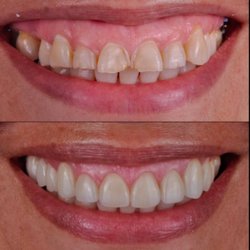 Smile Design Center of Westchester - Smile Design Center of Westchester, before and after