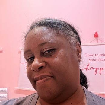 The Only Facial St. Charles - Before - Acne Treatment Near Me - Saint Charles, Missouri The Only Facial St. Charles - Before - Acne Treatment Near Me - Saint Charles, Missouri