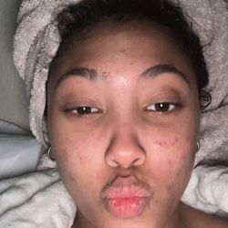 Derma Elite 101