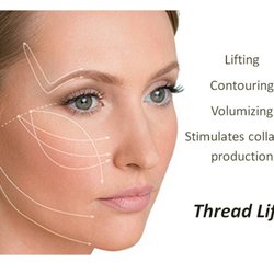 No Tears Dental - PDO (polydioxanone) Thread Lift
