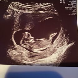 Mommy and Me 3D 4D Ultrasound - Keepsake ultrasound pic at 11 weeks