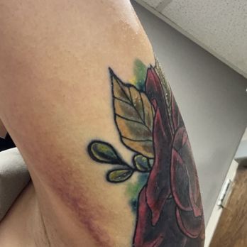 Blue Lotus Tattoo - Huge bruise from 2nd tattoo - Tattoo Near Me - Salem, Virginia Blue Lotus Tattoo - Huge bruise from 2nd tattoo - Tattoo Near Me - Salem, Virginia