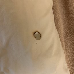 cigarette burn in pillowcase